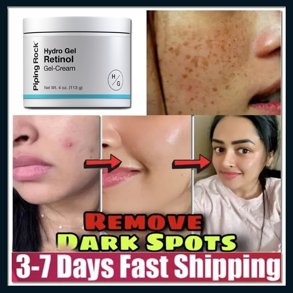 Retinol Anti-Aging Cream for Wrinkles & Skin Tightening 113g