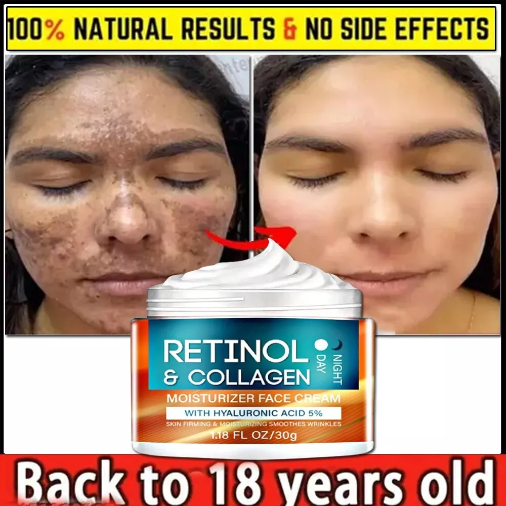 Retinol Cream for Wrinkles and Skin Tightening 30gm Free Shipping