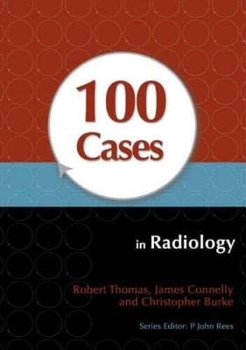 100 Cases in Radiology by Robert Thomas: New