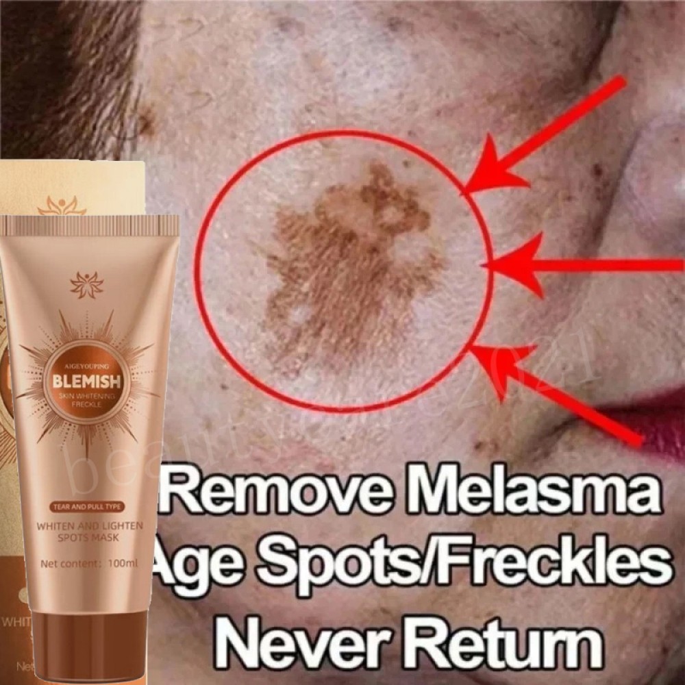 Herbal Spots Peel-Off Facial Mask Skin Care Beauty Treatment Lightening Spot USA