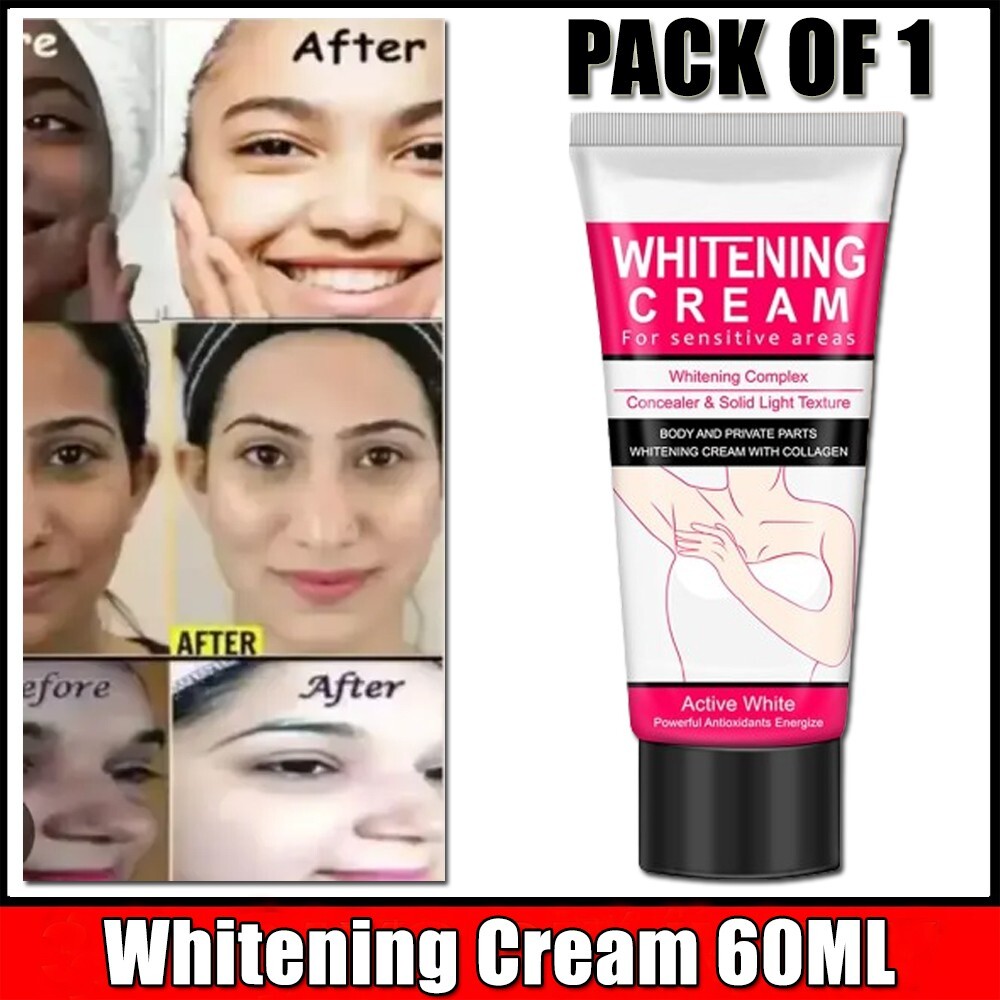 Pimples Melasma Blemish Removal Freckle Whitening Cream 60ML