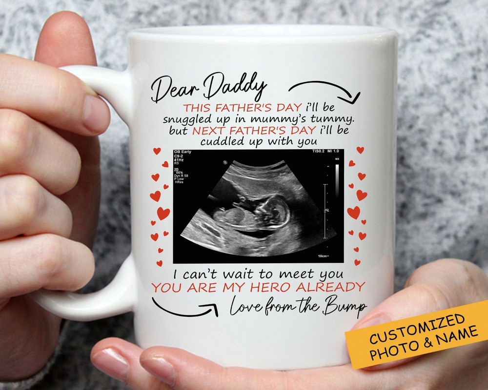 I Can't Wait To Meet You Dad Personalized Mug Ultrasound Photo Mug Gift For