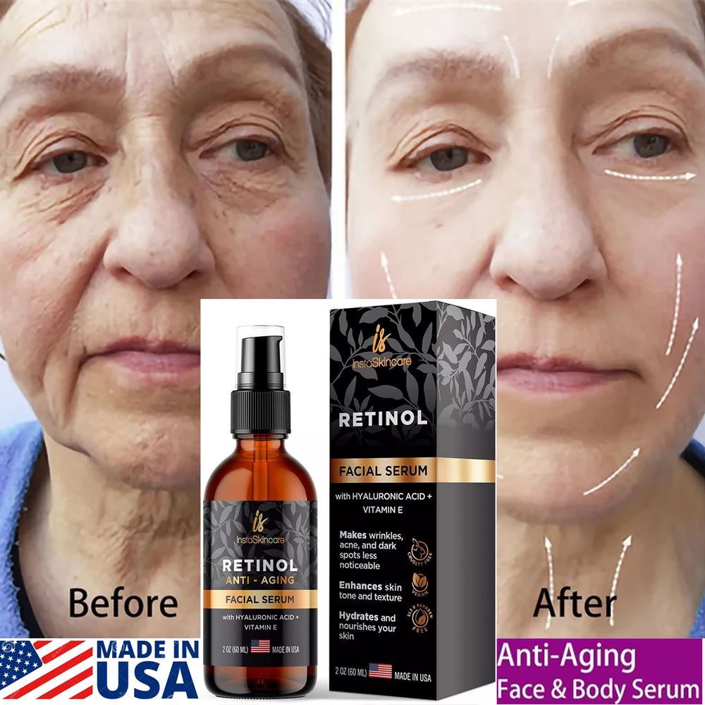 2oz - #1 BEST Anti Aging Vitamin C Serum with Retinol Serum and Hyaluronic Acid