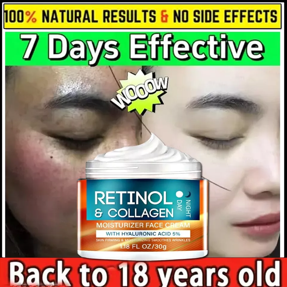 Retinol Cream with Hyaluronic Acid for Day & Night Anti-Aging 30gm